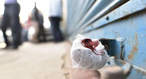 No cooperation from Civic Bodies in Sealing Drive: Municipal Committee tells SC